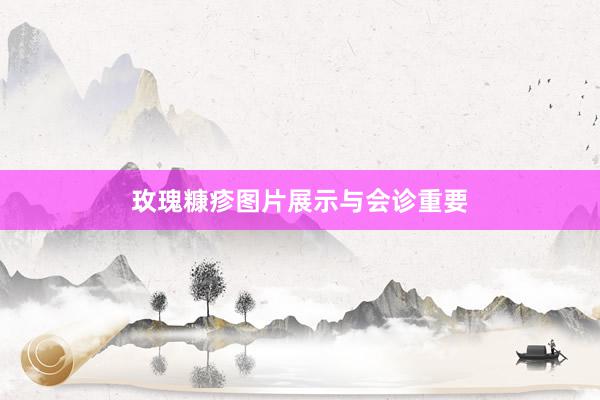 玫瑰糠疹图片展示与会诊重要